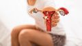 Un diagnóstico precoz y su tratamiento podrían incluso prevenir la infertilidad