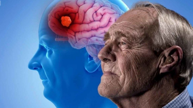 La infección por ciertos patógenos podría contribuir a la neurodegeneración propia de este tipo de demencia.
