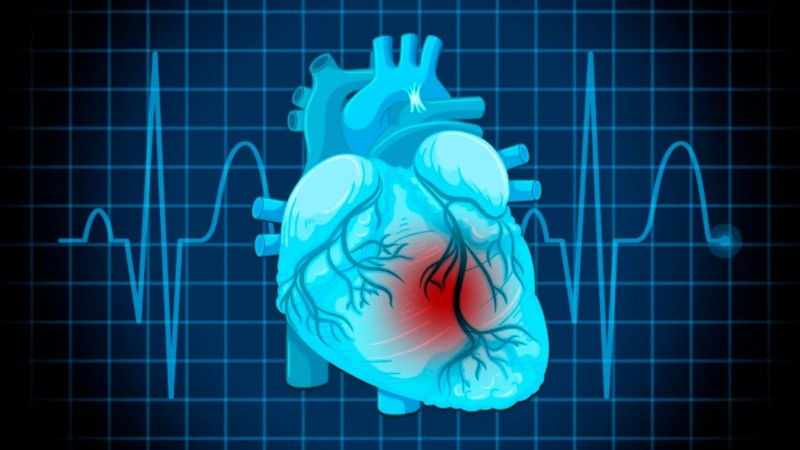 La fibrilación ventricular es la principal causa inmediata de muerte súbita cardíaca.