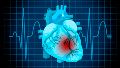 La fibrilación ventricular es la principal causa inmediata de muerte súbita cardíaca.