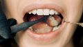 El control odontológico, mínimamente anual, resulta clave para conocer los cuidados particulares de la propia boca.
